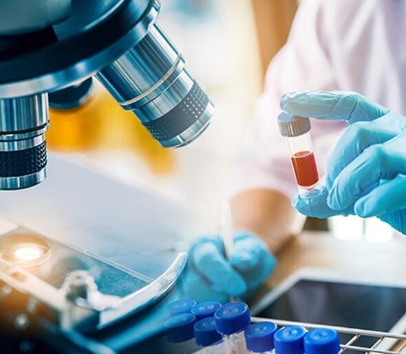 healthcare-seesaw-3-min Close-up of a scientist's gloved hand holding a test tube with a blood sample, alongside a microscope and lab equipment, representing advanced medical research and laboratory diagnostics